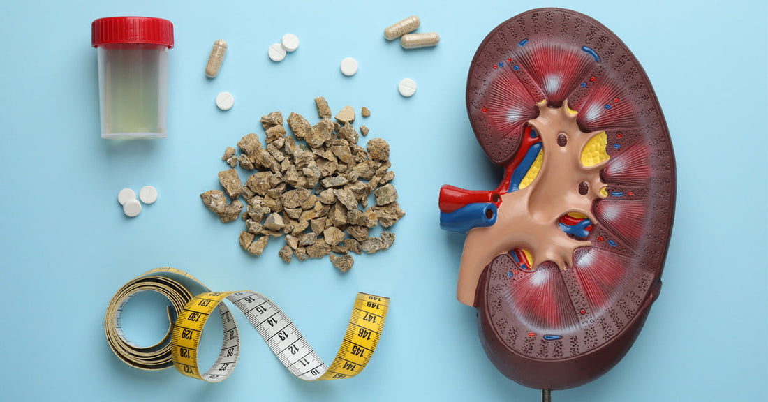 Ayurvedic treatment for kidney stone